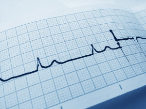 Blue Electrocardiogram Free Stock Photo