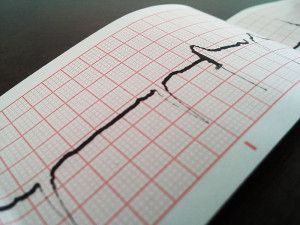 Electrocardiogram Free Stock Photo